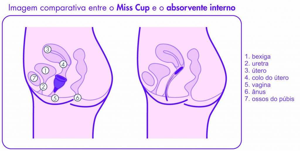 anatomia feminina comparacao coletor misscup absorvente interno