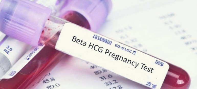 Teste Beta HCG Laboratório